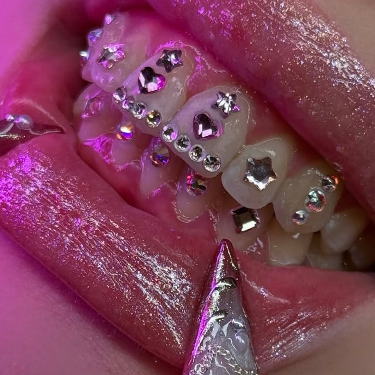 Micro Star tooth gems