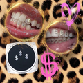 Dollar gems